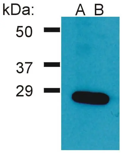 WB analysis of Ramos cell lysate using GTX00529 GRB2 antibody [PAb (554)].