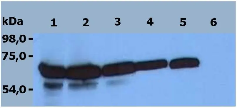 WB analysis of HPB-ALL cell lysate using GTX00530 ZAP70 antibody [ZAP-03]. Lane 1, 2, 3, 4 : GTX00530 (Dilution : 4, 2, 1, 0.5 microg/ml) Lane 5 : anti-ZAP-70 comparative antibody Lane 6 : mouse IgG1 isotype control