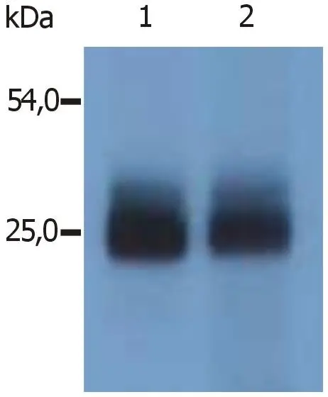 WB analysis of mouse spleen tissue (non-reducing) using GTX00531 NTAL antibody [PAb (487)].<br>Lane 1 : GTX00531 Lane 2 : polyclonal anti-mouse NTAL antibody (specific for N-terminal domain of mouse NTAL)