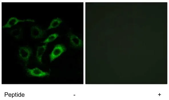 ICC/IF analysis of A549 cells using GTX00621 PTGDR antibody.