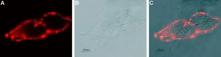 Live cell imaging analysis of LN-CaP cells using GTX00627 KCNN4 antibody [6C1]. Panel A : Primary antibody Panel B : Live view of the cells Panel C : Merged of panel A and B Dilution : 1:20