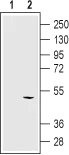 WB analysis of HEK cells transfected with human KCNN4 using GTX00627 KCNN4 antibody [6C1]. Lane 1 : HEK cells transfected with control vector Lane 2 : HEK cells transfected with human KCa3.1 Dilution : 1:250