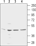 WB analysis of various samples using GTX00627 KCNN4 antibody [6C1]. Lane 1 : MS1 cell lysate Lane 2 : IEC-6 cell lysate Lane 3 : LN-CaP cell lysate Lane 4 : THP-1 cell lysate Dilution : 1:250
