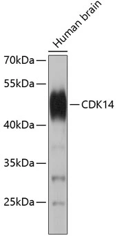 WB analysis of human brain lysate using GTX00630 PFTK1 antibody. Loading : 25microg per lane WB analysis of human brain lysate using GTX00630 PFTK1 antibody. Loading : 25microg per lane