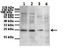 WB anaylsis of HK-2, MC3T3-E1, MLO-Y4 and rat Walker tumor extract using GTX00631 PTHLH antibody.<br>Dilution : 1:1000<br>Loading : 30-40?g
