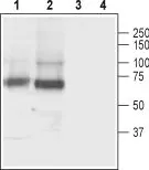 WB analysis of rat (lanes 1 and 3) and mouse (lanes 2 and 4) brain lysates using GTX00634 GAT3 antibody.<br>Lane 1 and 2 : Primary antibody<br>Lane 3 and 4 : Primary antibody preincubated with the negative control antigen<br>Dilution : 1:500