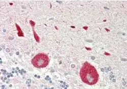 IHC-P analysis of human brain, cerebellum tissue using GTX00635 STYK1 antibody. Dilution : 1:100 IHC-P analysis of human brain, cerebellum tissue using GTX00635 STYK1 antibody. Dilution : 1:100