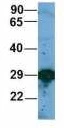 WB analysis of Jurkat cell lysate using GTX00636 EIF4E2 antibody. Dilution : 1 microg/ml WB analysis of Jurkat cell lysate using GTX00636 EIF4E2 antibody. Dilution : 1 microg/ml