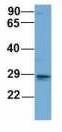 WB analysis of human adult placenta tissue lysate using GTX00636 EIF4E2 antibody. Dilution : 1 microg/ml