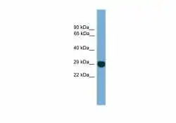 WB analysis of MCF7 cell lysate using GTX00636 EIF4E2 antibody. Dilution : 0.2-1 microg/ml