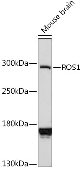 WB analysis of mouse brain lysate using GTX00638 ROS antibody.<br>Dilution : 1:1000?<br>Loading : 25?g per lane<br>Detection: ECL Enhanced Kit