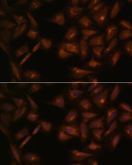 ICC/IF analysis of U2OS cells using GTX00641 MCP1 / CCL2 antibody.<br>Red : Primary antibody<br>Blue: DAPI for nuclear staining<br>Dilution : 1:100