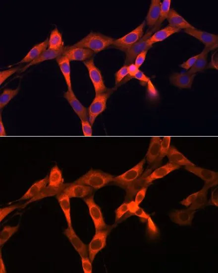 ICC/IF analysis of NIH/3T3 cells using GTX00641 MCP1 / CCL2 antibody. Blue : DAPI Dilution : 1:100