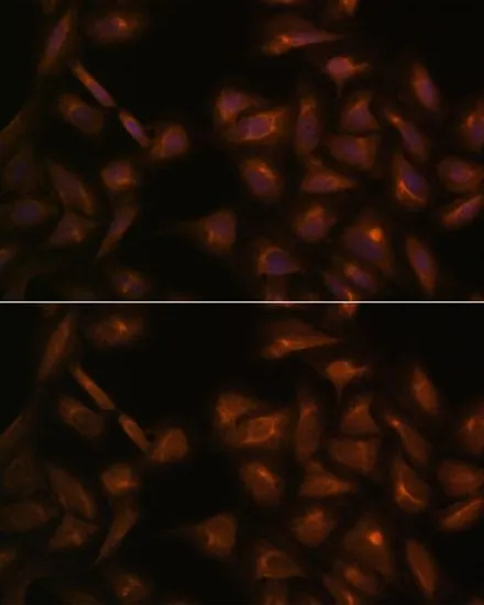 ICC/IF analysis of U2OS cells using GTX00641 MCP1 / CCL2 antibody. Blue : DAPI Dilution : 1:100