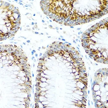 IHC-P analysis of human colon tissue using GTX00641 MCP1 / CCL2 antibody. Dilution : 1:100