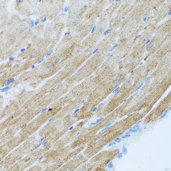 IHC-P analysis of mouse heart tissue using GTX00641 MCP1 / CCL2 antibody. Dilution : 1:100