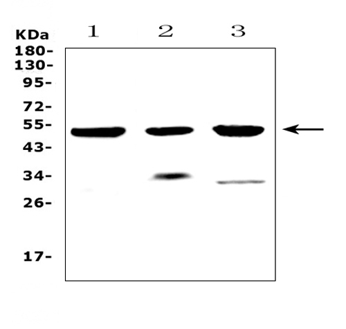WB analysis of various samples using GTX00643 HtrA1 antibody. Lane 1 : MCF-7 whole cell lysates Lane 2 : rat heart tissue lysates Lane 3 : mouse heart tissue lysates Dilution : 0.5microg/ml Loading : 50microg per lane