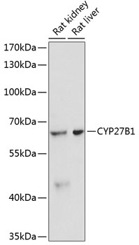 WB analysis of various samples using GTX00645 CYP27B1 antibody.<br>Dilution : 1:3000?<br>Loading : 25?g per lane