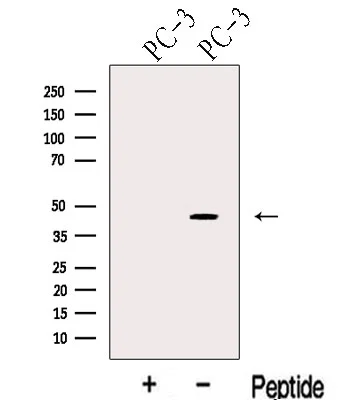 WB analysis of PC-3 cell lysates using GTX00646 KLF6 antibody. The lane on the left was treated with blocking peptide. WB analysis of PC-3 cell lysates using GTX00646 KLF6 antibody. The lane on the left was treated with blocking peptide.