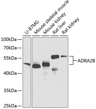 WB analysis of various samples using GTX00651 alpha 2b Adrenergic Receptor antibody.<br>Dilution : 1:1000?<br>Loading : 25?g per lane