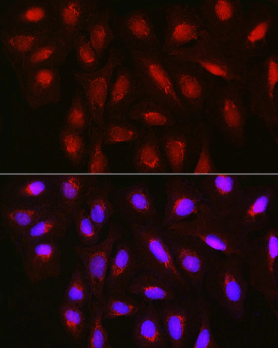 ICC/IF analysis of U2OS cells using GTX00657 TET3 antibody. Red : Primary antibody Blue : DAPI Dilution : 1:100 ICC/IF analysis of U2OS cells using GTX00657 TET3 antibody. Red : Primary antibody Blue : DAPI Dilution : 1:100