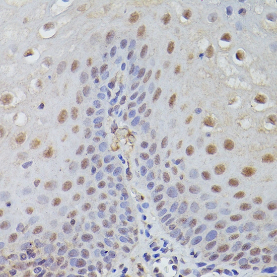 IHC-P analysis of human esophageal tissue using GTX00657 TET3 antibody. Antigen retrieval : High pressure antigen retrieval with 0.01M Citrate Bufferr (pH 6.0) Dilution : 1:50