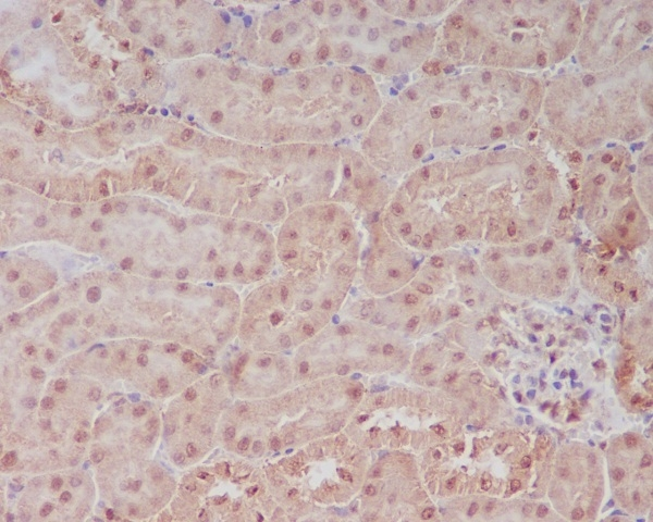 IHC-P analysis of mouse kidney tissue using GTX00668 PELP1 antibody [COD-16].<br>Antigen retrieval : Heat mediated antigen retrieval was performed in citrate buffer (pH6, epitope retrieval solution) for 20 mins<br>Dilution : 1 ?g/mL