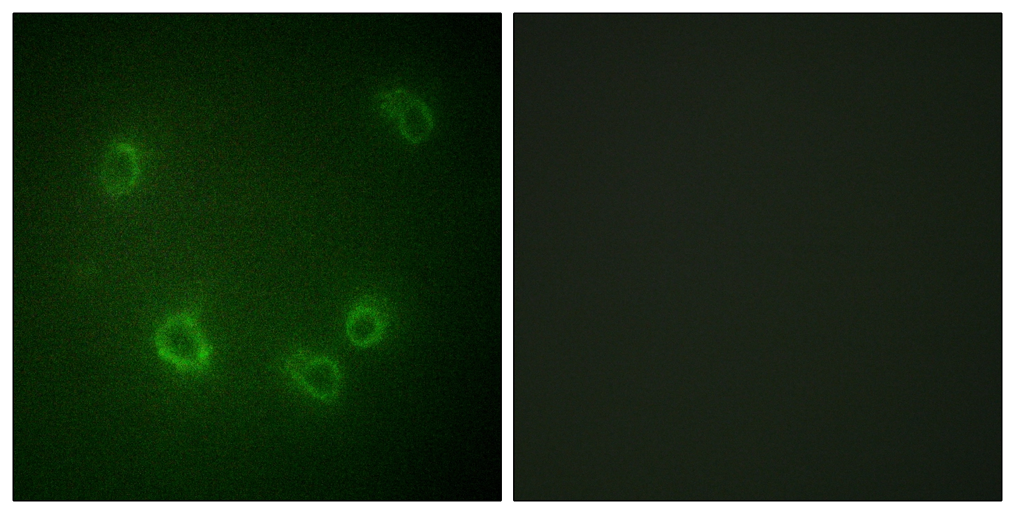ICC/IF analysis of COS7 cells using GTX00671 ENaC Beta (phospho Thr615) antibody. The picture on the right is blocked with the phospho peptide.