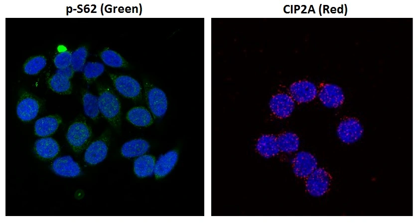 ICC/IF analysis of HeLa cells using GTX00684 c-Myc (phospho Ser62) antibody [33A12E10] (Green, Left) or proximity Ligation Analysis with anti-c-Myc pS62 and CIP2A antibodies, association of c-Myc pS62 with CIP2A (Right, red) in nuclei (DAPI, blue).