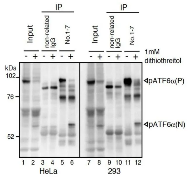 IP analysis of HeLa or 293 cell lysates using GTX00687 ATF6 antibody [1-7]. It is recommended using a light chain specific anti-mouse IgG antibody as a secondary antibody. Lane 1, 2, 7, and 8 : Input Lanes 3, 4, 9, and 10 : Non-related IgG as IP antibody Lanes 5, 6, 11, and 12 : GTX00687 as IP antibody IB antibody: GTX00687 ATF6 antibody [1-7]