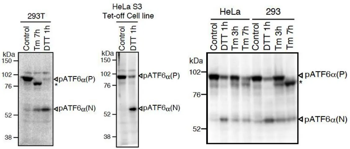 WB analysis of various samples using GTX00687 ATF6 antibody [1-7]. The asterisk denotes an unglycosylated form of pATF6alpha(P). ATF6alpha is constitutively expressed as pATF6alpha(P), and converted to pATF6alpha(N) ( > 50-kDa protein) in ER-stressed cells. pATF6alpha(P) : the endogenous precursor ATF6 alpha (~90kDa) pATF6alpha(N) : the cleaved product of ATF6 alpha (>50kDa) Tm: cells treated with 2 microg/ml tunicamycin (inhibitor of N-glycosylation)< br>DTT: cells treated with 1mM dithiothreitol (reducing reagent). Loading : 50microg