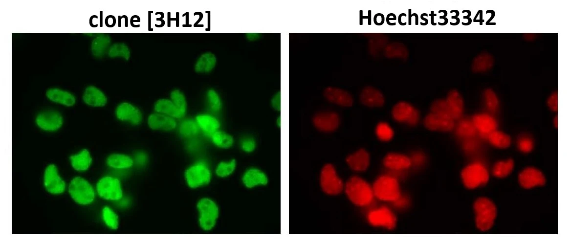 ICC/IF analysis of mouse primary neural progenitor cells using GTX00699 SUMO2 + SUMO3 antibody [3H12].