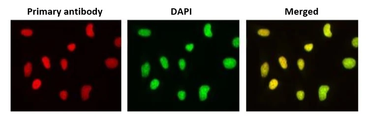 ICC/IF analysis of HeLa cells using GTX00700 PHLDA3 antibody [4B6]. Dilution : 1:1000 Fixation : 4% PFA Permeabilization: 0.25% Triton X-100 in PBS for 10 min