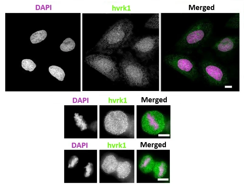 ICC/IF analysis of U2OS cells using GTX00703 VRK1 antibody [5D1]. Upper panel : Interphase cells Middle and lower panel : Metaphase cells Dilution : 1:100 Fixation : 4% PFA