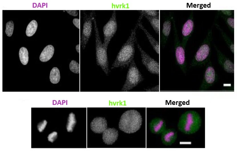ICC/IF analysis of HeLa cells using GTX00703 VRK1 antibody [5D1]. Upper panel : Interphase cells Lower panel : Metaphase cells Dilution : 1:100 Fixation : 4% PFA