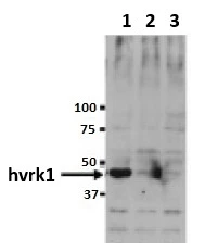 WB analysis of HeLa cell lysate using GTX00703 VRK1 antibody [5D1]. Samples : Lane 1 : HeLa cells transfected Luciferase RNAi (control) Lane 2 : HeLa cells transfected VRK1-1 RNAi Lane 3 : HeLa cells transfected VRK1-2 RNAi Dilution : 1:500