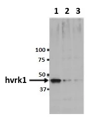 WB analysis of TIG-1 cell lysate using GTX00703 VRK1 antibody [5D1]. Samples : Lane 1 : TIG-1 cells transfected Luciferase RNAi (control) Lane 2 : TIG-1 cells transfected VRK1-1 RNAi Lane 3 : TIG-1 cells transfected VRK1-2 RNAi Dilution : 1:500