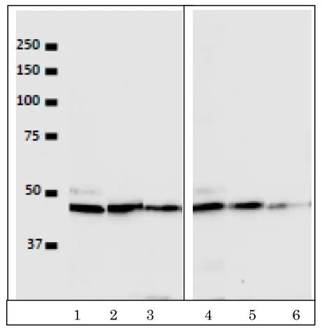 WB analysis of various samples using GTX00703 VRK1 antibody [5D1]. Lane 1-3 : HeLa whole cell lysate Lane 4-6 : U2OS whole cell lysate Dilution : Lane 1, 4 : 1:100 Lane 2, 5 : 1:500 Lane 3, 6 : 1:1000 Cell amount : 5 x10? cells
