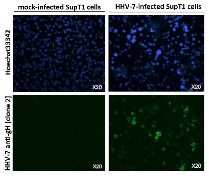 AntiHerpes virus 7 gH antibody [2] (GTX00709)