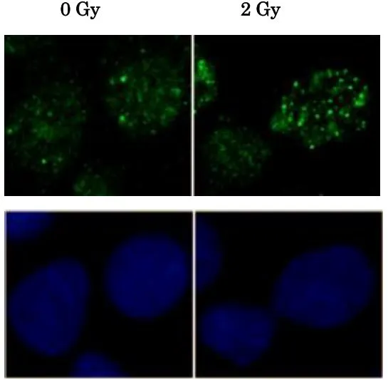 ICC/IF analysis of U2OS cells irradiated by X-ray (2 Gy) for 2hrs using GTX00719 Rad51 antibody.<br>Green : Primary antibody<br>Blue : Hoechst 33342<br>Dilution : 1:6000