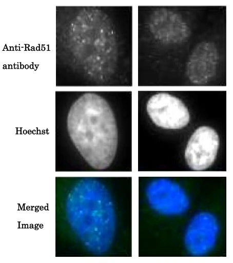 ICC/IF analysis of GM0637 cells irradiated by X-rays (2 Gy) for 1 hr using GTX00721 Rad51 antibody. Left : 1:100 dilution for 30 min at 37 degree C Right : 1:1000 for 30 min at 37 degree C Fixation : 4% PFA for 10 min Permeabilization : 0.5% Triton X-100 for 5 min ICC/IF analysis of GM0637 cells irradiated by X-rays (2 Gy) for 1 hr using GTX00721 Rad51 antibody. Left : 1:100 dilution for 30 min at 37 degree C Right : 1:1000 for 30 min at 37 degree C Fixation : 4% PFA for 10 min Permeabilization : 0.5% Triton X-100 for 5 min