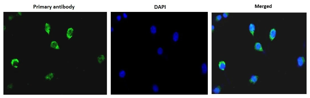 ICC/IF analysis of NIH-3T3 cells using GTX00722 DNA polymerase beta antibody. Dilution : 1:1000 Fixation : 4% PFA Permeabilization : 0.25% Triton X-100 ICC/IF analysis of NIH-3T3 cells using GTX00722 DNA polymerase beta antibody. Dilution : 1:1000 Fixation : 4% PFA Permeabilization : 0.25% Triton X-100
