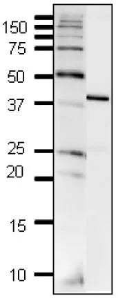 WB analysis of HeLa whole cell lysate using GTX00722 DNA polymerase beta antibody.<br>Dilution : 1:2000<br>Loading : 10 ?g