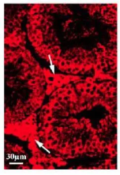 IHC-Fr analysis of mouse testis tissue section using GTX00724 DDX3 antibody. Arrows indicate Leydig cells. Dilution : 1:200