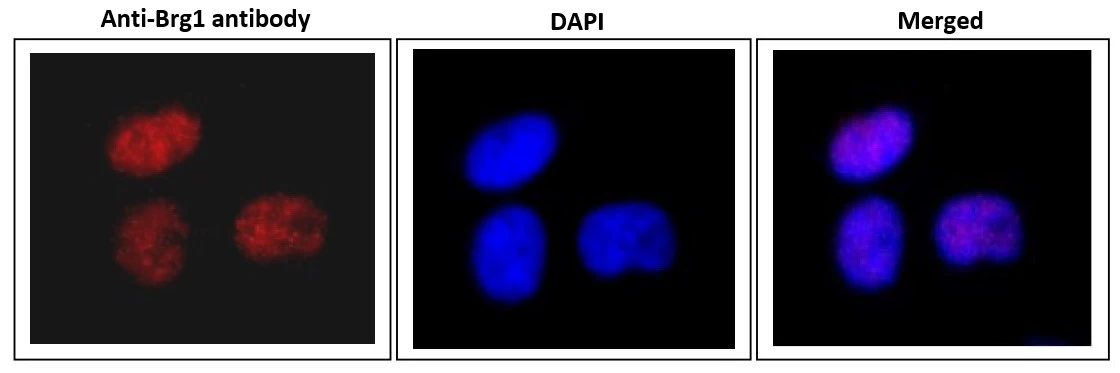 ICC/IF analysis of HeLa cells using GTX00727 BRG1 antibody. Dilution : 1:1000 Fixation : 4% PFA, overnight Permeabilization : 0.25% Triton X-100 in PBS for 10 min ICC/IF analysis of HeLa cells using GTX00727 BRG1 antibody. Dilution : 1:1000 Fixation : 4% PFA, overnight Permeabilization : 0.25% Triton X-100 in PBS for 10 min