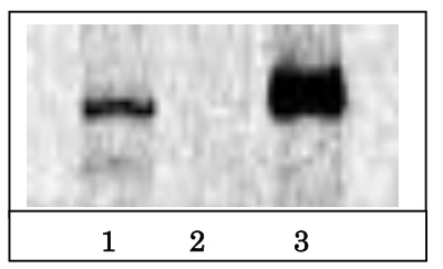 IP analysis of HeLa nuclear extracts using GTX00727 BRG1 antibody. Lane 1 : Input nuclear extracts Lane 2 : Control IP with non-immune IgG Lane 3 : Immunoprecipitation with anti-Brg1 antibody