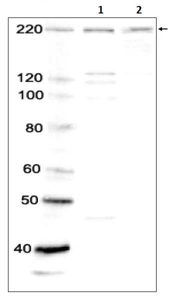 WB analysis of various samples using GTX00727 BRG1 antibody. Lane 1 : HeLa whole cell lysate Lane 2 : NIH3T3 whole cell lysate Dilution : 1:1000