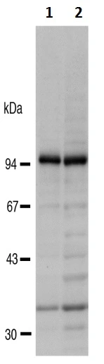 WB analysis of various samples using GTX00728 RanBP9 antibody.<br>Lane 1 : HeLa whole cell lysate<br>Lane 2 : U2OS whole cell lysate<br>Dilution : 1:2000