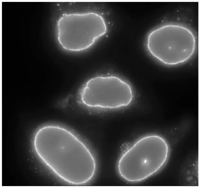 ICC/IF analysis of HeLa cells using GTX00729 RANBP2 antibody.<br>Dilution : 1:2000<br>Fixation : 4% PFA
