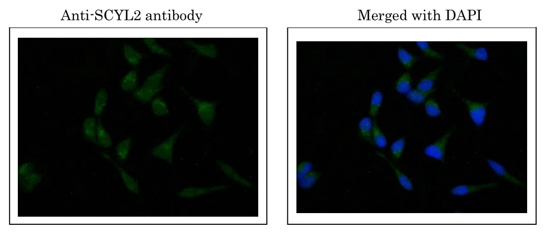 ICC/IF analysis of MCF-7 cells using GTX00732 SCYL2 antibody.<br>Green : Primary antibody<br>Blue : DAPI<br>Dilution : 1:1000<br>Fixation : 4% PFA<br>Permeabilization : 0.25% Triton X-100 in PBS